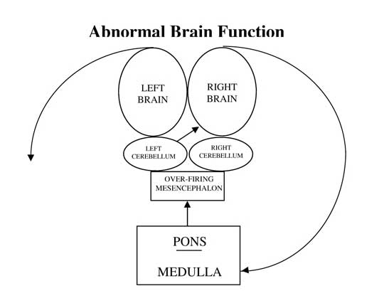 Chronic Pain Dacula GA Functional Neurology Abnormal Brain Function