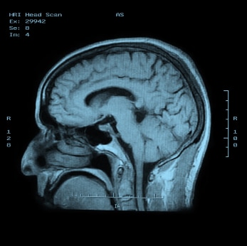 Chronic Pain Dacula GA Functional Neurology